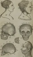 An illustration from Fowler's practical phrenology : giving a concise elementary view of phrenology : presenting some new and important remarks upon the temperaments : and describing the primary mental powers in seven different degrees of development : the mental phenomena produced by their combined action : and the location of the organs, amply illustrated by cuts : also the phrenological developments, together with the character and talents of ... as given by ... (1846)