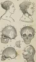 An illustration from Synopsis of phrenology and the phrenological developments : together with the character and talents of [blank] as given by [blank] : with reference to those pages of "Phrenology proved, illiustrated, and applied," in which will be found a full and correct delineation of the intellectual and moral character and manifestations of the above-named individual (1838)