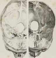 An illustration from An examination of phrenology : in two lectures : delivered to the students of the Columbian College, District of Columbia, February, 1837 (1839)