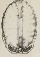 An illustration from An examination of phrenology : in two lectures : delivered to the students of the Columbian College, District of Columbia, February, 1837 (1839)
