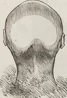 An illustration from Marriage, its history and ceremonies : with a phrenological and physiological exposition of the functions and qualifications for happy marriages (1848)