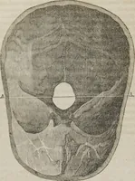 Picture 5 of 7 from Matrimony, or, Phrenology and physiology applied to the selection of congenial companions for life : including directions to the married for living together affectionately and happily (1851), leaf 25