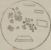 An illustration from Illustrations of disease with the microscope. clinical investigations, aided by the microscope, and by chemical reagents, with microscopical observations of pathological specimens, medical and surgical, obtained in Charleston, S.C. : a contribution intended to disclose the minute history of the diseases prevailing in this latitude, and to assist future students (1861)