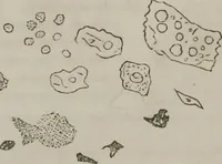 Picture 7 of 58 from Illustrations of disease with the microscope. clinical investigations, aided by the microscope, and by chemical reagents, with microscopical observations of pathological specimens, medical and surgical, obtained in Charleston, S.C. : a contribution intended to disclose the minute history of the diseases prevailing in this latitude, and to assist future students (1861), leaf 103