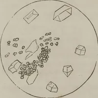 An illustration from Illustrations of disease with the microscope. clinical investigations, aided by the microscope, and by chemical reagents, with microscopical observations of pathological specimens, medical and surgical, obtained in Charleston, S.C. : a contribution intended to disclose the minute history of the diseases prevailing in this latitude, and to assist future students (1861)
