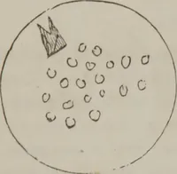 Picture 11 of 58 from Illustrations of disease with the microscope. clinical investigations, aided by the microscope, and by chemical reagents, with microscopical observations of pathological specimens, medical and surgical, obtained in Charleston, S.C. : a contribution intended to disclose the minute history of the diseases prevailing in this latitude, and to assist future students (1861), leaf 106