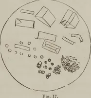 An illustration from Illustrations of disease with the microscope. clinical investigations, aided by the microscope, and by chemical reagents, with microscopical observations of pathological specimens, medical and surgical, obtained in Charleston, S.C. : a contribution intended to disclose the minute history of the diseases prevailing in this latitude, and to assist future students (1861)