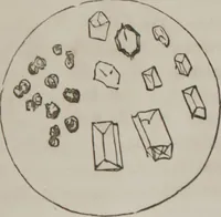 An illustration from Illustrations of disease with the microscope. clinical investigations, aided by the microscope, and by chemical reagents, with microscopical observations of pathological specimens, medical and surgical, obtained in Charleston, S.C. : a contribution intended to disclose the minute history of the diseases prevailing in this latitude, and to assist future students (1861)