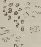 An illustration from Illustrations of disease with the microscope. clinical investigations, aided by the microscope, and by chemical reagents, with microscopical observations of pathological specimens, medical and surgical, obtained in Charleston, S.C. : a contribution intended to disclose the minute history of the diseases prevailing in this latitude, and to assist future students (1861)