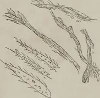 An illustration from Illustrations of disease with the microscope. clinical investigations, aided by the microscope, and by chemical reagents, with microscopical observations of pathological specimens, medical and surgical, obtained in Charleston, S.C. : a contribution intended to disclose the minute history of the diseases prevailing in this latitude, and to assist future students (1861)