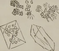An illustration from Illustrations of disease with the microscope. clinical investigations, aided by the microscope, and by chemical reagents, with microscopical observations of pathological specimens, medical and surgical, obtained in Charleston, S.C. : a contribution intended to disclose the minute history of the diseases prevailing in this latitude, and to assist future students (1861)