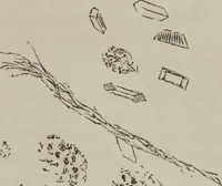 An illustration from Illustrations of disease with the microscope. clinical investigations, aided by the microscope, and by chemical reagents, with microscopical observations of pathological specimens, medical and surgical, obtained in Charleston, S.C. : a contribution intended to disclose the minute history of the diseases prevailing in this latitude, and to assist future students (1861)