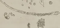 An illustration from Illustrations of disease with the microscope. clinical investigations, aided by the microscope, and by chemical reagents, with microscopical observations of pathological specimens, medical and surgical, obtained in Charleston, S.C. : a contribution intended to disclose the minute history of the diseases prevailing in this latitude, and to assist future students (1861)