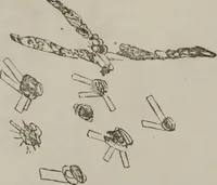 An illustration from Illustrations of disease with the microscope. clinical investigations, aided by the microscope, and by chemical reagents, with microscopical observations of pathological specimens, medical and surgical, obtained in Charleston, S.C. : a contribution intended to disclose the minute history of the diseases prevailing in this latitude, and to assist future students (1861)