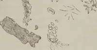 An illustration from Illustrations of disease with the microscope. clinical investigations, aided by the microscope, and by chemical reagents, with microscopical observations of pathological specimens, medical and surgical, obtained in Charleston, S.C. : a contribution intended to disclose the minute history of the diseases prevailing in this latitude, and to assist future students (1861)