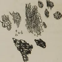 An illustration from Illustrations of disease with the microscope. clinical investigations, aided by the microscope, and by chemical reagents, with microscopical observations of pathological specimens, medical and surgical, obtained in Charleston, S.C. : a contribution intended to disclose the minute history of the diseases prevailing in this latitude, and to assist future students (1861)