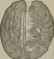 An illustration from The mysteries of human nature explained by a new system of nervous physiology : to which is added, a review of the errors of spiritualism, and instructions for developing or resisting the influence by which subjects and mediums are made (1857)