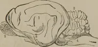 Picture 40 of 65 from The mysteries of human nature explained by a new system of nervous physiology : to which is added, a review of the errors of spiritualism, and instructions for developing or resisting the influence by which subjects and mediums are made (1857), leaf 148