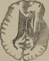 An illustration from The mysteries of human nature explained by a new system of nervous physiology : to which is added, a review of the errors of spiritualism, and instructions for developing or resisting the influence by which subjects and mediums are made (1857)