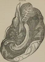 Picture 47 of 65 from The mysteries of human nature explained by a new system of nervous physiology : to which is added, a review of the errors of spiritualism, and instructions for developing or resisting the influence by which subjects and mediums are made (1857), leaf 182