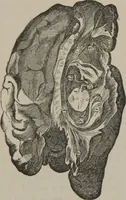 An illustration from The mysteries of human nature explained by a new system of nervous physiology : to which is added, a review of the errors of spiritualism, and instructions for developing or resisting the influence by which subjects and mediums are made (1857)