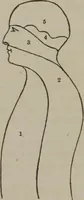 Picture 14 of 65 from The mysteries of human nature explained by a new system of nervous physiology : to which is added, a review of the errors of spiritualism, and instructions for developing or resisting the influence by which subjects and mediums are made (1857), leaf 81