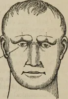 An illustration from The illustrated self-instructor in phrenology and physiology : with over one hundred engravings : together with the chart and character of ... as marked by ... (1859)
