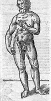 An illustration from Opera observationum et curationum medico-chirurgicarum, quae exstant omnia (1682)