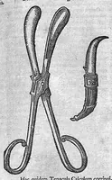 An illustration from Opera observationum et curationum medico-chirurgicarum, quae exstant omnia (1682)