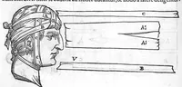 An illustration from Chirurgia è graeco in latinum conversa, Vido Vidio Florentino interprete, cum nonnullis ejusdem Vidii co[m]mentariis (1544)