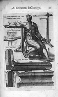 An illustration from Les Oeuvres de chirurgie de Jacques Guillemeau, chirurgien ordinaire du Roy et Juré à paris, divisées en treize livres. Avec les Portraicts & Figures Anatomiques de toutes les parties du corps humain. Et des Instrumens necessaires au Chirurgien. Derniere edition (1602)