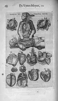 An illustration from Les Oeuvres de chirurgie de Jacques Guillemeau, chirurgien ordinaire du Roy et Juré à paris, divisées en treize livres. Avec les Portraicts & Figures Anatomiques de toutes les parties du corps humain. Et des Instrumens necessaires au Chirurgien. Derniere edition (1602)