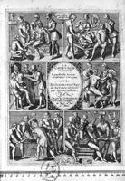 An illustration from La chirurgie françoise, recueillie des Anciens Medecins et Chirurgiens avec plusieurs figures des Instrumens necesseres pour l’operation Manuelle par Jacques Guillemeau D’Orleans, Chirurgien du Roy et Juré a Paris (1594)