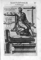 Picture 7 of 10 from La chirurgie françoise, recueillie des Anciens Medecins et Chirurgiens avec plusieurs figures des Instrumens necesseres pour l’operation Manuelle par Jacques Guillemeau D’Orleans, Chirurgien du Roy et Juré a Paris (1594), leaf 34