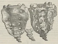 An illustration from Andreae Vesalii,... de Humani corporis fabrica libri septem... (1543)