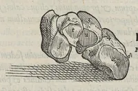 An illustration from Andreae Vesalii,... de Humani corporis fabrica libri septem... (1543)