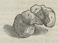 An illustration from Andreae Vesalii,... de Humani corporis fabrica libri septem... (1543)