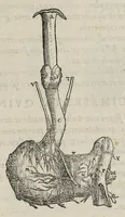 An illustration from Andreae Vesalii,... de Humani corporis fabrica libri septem... (1543)