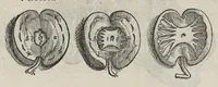 An illustration from Andreae Vesalii,... de Humani corporis fabrica libri septem... (1543)