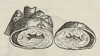Picture 55 of 64 from Andreae Vesalii,... de Humani corporis fabrica libri septem... (1543), leaf 590