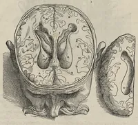 An illustration from Andreae Vesalii,... de Humani corporis fabrica libri septem... (1543)