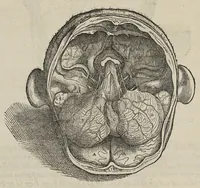 An illustration from Andreae Vesalii,... de Humani corporis fabrica libri septem... (1543)