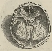 An illustration from Andreae Vesalii,... de Humani corporis fabrica libri septem... (1543)