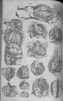 An illustration from Les portraits anatomiques de toutes les parties du corps humain, gravez en taille douce, par le commandement de feu Henry huictiesme, Roy d’Angleterre. Ensemble l’Abbregé d’André Vesal, et l’explication d’iceux, accompagnee d’une declaration Anatomique. Par Jaques Grevin, de Clermont en Beauvoisis, Medecin à Paris, (1569)