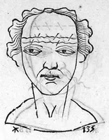 An illustration from Metoposcopia liber tredecim, et octingentis faciei humanae eiconibus complexa : cui accessit melampodis de naevis corporis tractatus, graece et latine nunc primum editus (1658)
