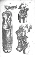 An illustration from Historia anatomica humani corporis et singularum ejus partium multis controversiis et observationibus novis (1627)