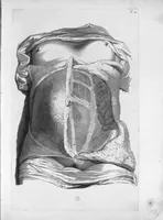 An illustration from Anatomia humani corporis, centum et quinque tabulis, per artificiosiss. G. de Lairesse ad vivum delineatis, demonstrata ... (1685)