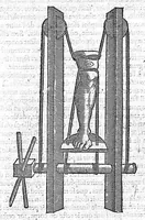 Picture 10 of 19 from Les Oeuvres d'Ambroise Paré,... divisées en vingt huict livres avec les figures et portraicts, tant de l'anatomie que des instruments de chirurgie, et de plusieurs monstres, reveuës et augmentées par l'autheur. Quatriesme Edition. (1585), leaf 569