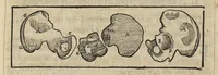 An illustration from L'Oeconomie chirurgicale, pour le r'habillement des os du corps humain contenant l'ostéologie, la nososreologie, l'apocatastosteologie, & le Traitté des bandages (1671)