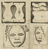 Picture 15 of 30 from L'Oeconomie chirurgicale, pour le r'habillement des os du corps humain contenant l'ostéologie, la nososreologie, l'apocatastosteologie, & le Traitté des bandages (1671), leaf 394